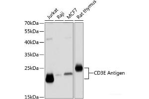 Western blot analysis of extracts of various cell lines using CD3E Antigen Polyclonal Antibody at dilution of 1:1000. (CD3 epsilon antibody)