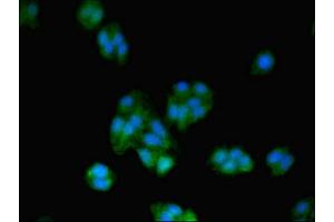 Immunofluorescent analysis of HepG2 cells using ABIN7172487 at dilution of 1:100 and Alexa Fluor 488-congugated AffiniPure Goat Anti-Rabbit IgG(H+L) (BTF3 antibody  (AA 48-206))