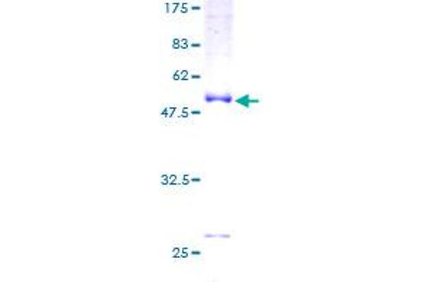 TNNI1 Protein (AA 1-187) (GST tag)