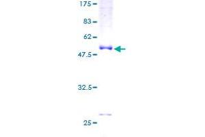 Image no. 1 for Slow Skeletal Troponin I (TNNI1) (AA 1-187) protein (GST tag) (ABIN1323277) (TNNI1 Protein (AA 1-187) (GST tag))