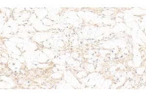 Immunohistochemistry (IHC) image for anti-TAR DNA Binding Protein (TARDBP) (AA 104-262) antibody (ABIN7434404)