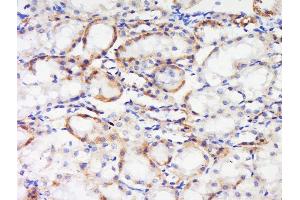 Paraformaldehyde-fixed, paraffin embedded rat kidney tissue, Antigen retrieval by boiling in sodium citrate buffer(pH6) for 15min, Block endogenous peroxidase by 3% hydrogen peroxide for 30 minutes, Blocking buffer (normal goat serum) at 37°C for 20min, Antibody incubation with Rabbit Anti-IGF1R (Tyr1165 + Tyr1166) Polyclonal Antibody, Unconjugated  at 1:500 overnight at 4°C, followed by a conjugated secondary and DAB staining (IGF1R antibody  (pTyr1165, pTyr1166))