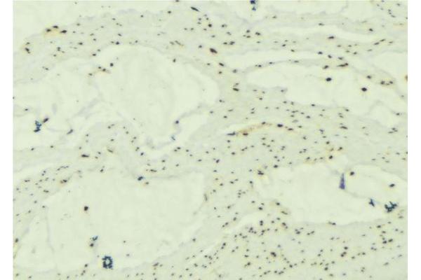 SNCG antibody  (C-Term)