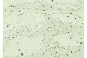 ABIN6277244 at 1/100 staining Mouse muscle tissue by IHC-P. (SNCG antibody  (C-Term))