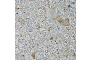 Immunohistochemistry of paraffin-embedded mouse brain using CALML5 antibody (ABIN5974468) at dilution of 1/100 (40x lens). (CALML5 antibody)