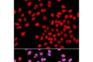 Immunofluorescence analysis of U2OS cells using IKZF1 Polyclonal Antibody (IKZF1 antibody)
