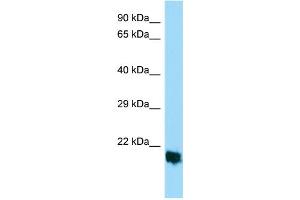 Host: Rabbit Target Name: MPLKIP Sample Type: HepG2 Whole Cell lysates Antibody Dilution: 1. (TTDN1 antibody  (Middle Region))