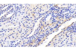 Detection of mTOR in Human Kidney Tissue using Monoclonal Antibody to Serine/threonine-protein kinase mTOR (mTOR) (MTOR antibody  (AA 2226-2488))