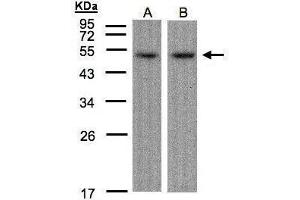 WB Image Sample(30 μg of whole cell lysate) A:Hep G2, B:Raji, 12% SDS PAGE antibody diluted at 1:1500 (AFT7 antibody  (C-Term))