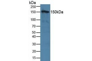 Detection of TJP2 in Human Hela Cells using Polyclonal Antibody to Tight Junction Protein 2 (TJP2) (TJP2 antibody  (AA 307-669))