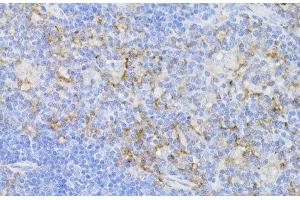 Immunohistochemistry of paraffin-embedded Mouse thymus using CD3E Antigen Polyclonal Antibody at dilution of 1:100 (40x lens). (CD3 epsilon antibody)
