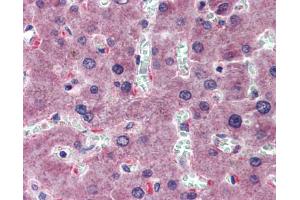 Immunohistochemistry (IHC) image for anti-Hyaluronidase-1 (HYAL1) (N-Term) antibody (ABIN2784342)