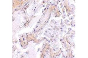 Immunohistochemistry of CAPN6 in human lung tissue with CAPN6 polyclonal antibody  at 2.