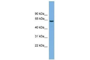 Western Blot showing SLCO1A2 antibody used at a concentration of 1-2 ug/ml to detect its target protein. (SLCO1A2 antibody  (Middle Region))