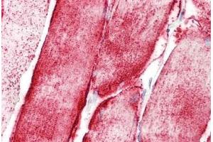 Human Skeletal Muscle: Formalin-Fixed, Paraffin-Embedded (FFPE) (STOX1 antibody  (C-Term))