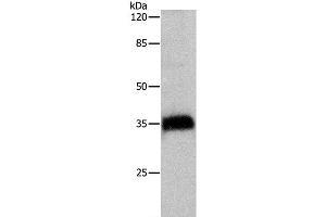 Western Blot analysis of Hela cell using CTSZ Polyclonal Antibody at dilution of 1:500 (Cathepsin Z antibody)