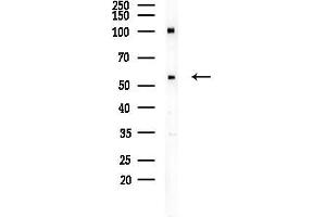 Western blot analysis of lysates from EC304 cells, using Cyclin A Antibody at 1/1000 dilution.