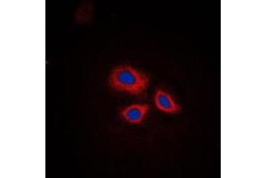 Immunofluorescent analysis of RNF144A staining in HepG2 cells. (RNF144A antibody  (Center))