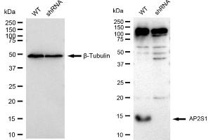 Western blotting analysis using AP2S1 antibody (ABIN7797511).