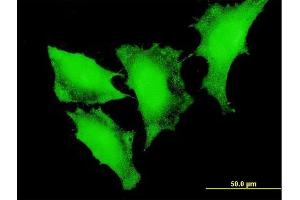 Immunofluorescence of monoclonal antibody to FOXO3 on HeLa cell. (FOXO3 antibody  (AA 361-460))