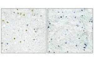 Immunohistochemistry analysis of paraffin-embedded human brain tissue using TRIM24 antibody. (TRIM24 antibody  (C-Term))