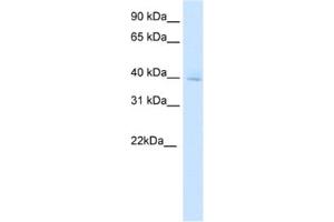 Western Blotting (WB) image for anti-Diencephalon/mesencephalon Homeobox 1 (DMBX1) antibody (ABIN2461530) (DMBX1 antibody)