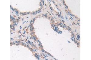 Used in DAB staining on fromalin fixed paraffin- embedded prostate gland tissue (ALOX12B antibody  (AA 479-701))