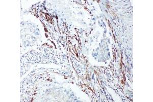 Immunohistochemistry (IHC) image for anti-SHC (Src Homology 2 Domain Containing) Transforming Protein 1 (SHC1) (C-Term) antibody (ABIN3032555)