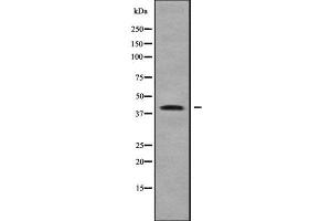 Western blot analysis of ZDHHC18 using LOVO whole cell lysates (ZDHHC18 antibody  (N-Term))