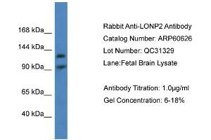 WB Suggested Anti-LONP2  Antibody Titration: 0. (LONP2 antibody  (C-Term))