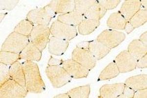 Immunohistochemistry (Paraffin-embedded Sections) (IHC (p)) image for anti-Dystrophia Myotonica-Protein Kinase (DMPK) antibody (ABIN7073790)