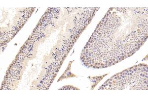 Detection of CTSD in Mouse Testis Tissue using Polyclonal Antibody to Cathepsin D (CTSD) (Cathepsin D antibody  (AA 66-410))