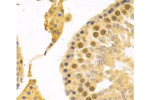 Immunohistochemistry of paraffin-embedded Rat testis using RFC4 Polyclonal Antibody at dilution of 1:100 (40x lens). (RFC4 antibody)