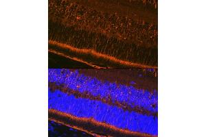 Immunofluorescence (IF) image for anti-Retinaldehyde Binding Protein 1 (RLBP1) antibody (ABIN7269934)