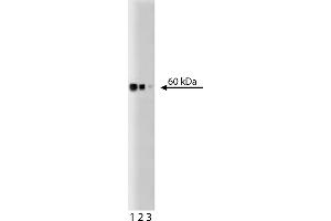 Western Blotting (WB) image for anti-Heat Shock 60kDa Protein 1 (Chaperonin) (HSPD1) antibody (ABIN968591) (HSPD1 antibody)