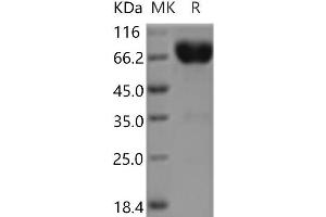 Western Blotting (WB) image for Interleukin 10 Receptor, beta (IL10RB) protein (Fc Tag) (ABIN7196363) (IL10RB Protein (Fc Tag))