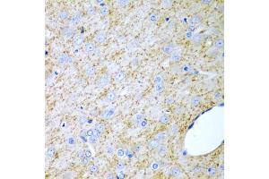 Immunohistochemistry of paraffin-embedded rat brain using INHA antibody. (Inhibin alpha antibody)