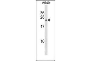 Western blot analysis of KCNMB1 Antibody (Center) in A549 cell line lysates (35ug/lane). (KCNMB1 antibody  (Middle Region))