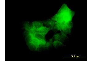 Immunofluorescence of monoclonal antibody to PRKCD on A-431 cell. (PKC delta antibody  (AA 577-676))