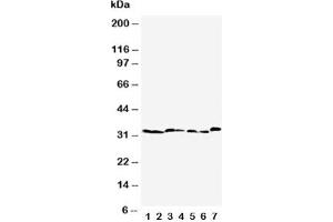Western blot testing of Caspase-6 antibody  and Lane 1:  rat liver;  2: rat kidney;  3: rat testis;  4: NRK;  5: mouse liver;  6: mouse kidney;  7: mouse testis tissue lysate (Caspase 6 antibody  (AA 7-27))