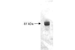Both the antiserum and IgG fractions of anti-Carboxypeptidase Y (Baker's Yeast) are shown to detect under reducing conditions of SDS-PAGE the 61,000 dalton enzyme in cellular extracts. (CPY antibody)