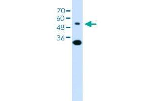 Western blot analysis of Jurkat cell lysate with SLC2A5 polyclonal antibody . (SLC2A5 antibody  (AA 300-349))