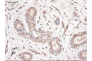 Immunohistochemical staining of paraffin-embedded breast using anti-NTF3 (ABIN2452548) mouse monoclonal antibody. (Neurotrophin 3 antibody  (AA 139-257))