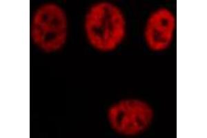 ABIN6274338 staining Hela cells by IF/ICC. (TCOF1 antibody  (N-Term))