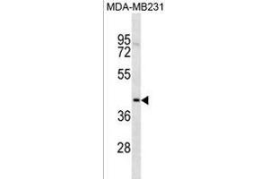 TOX2 Antibody (Center) (ABIN1881895 and ABIN2838436) western blot analysis in MDA-M cell line lysates (35 μg/lane). (TOX2 antibody  (AA 286-312))