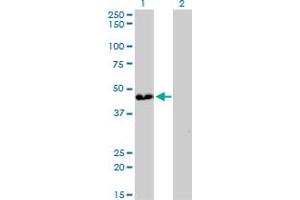 ATP6V0D1 antibody  (AA 238-309)