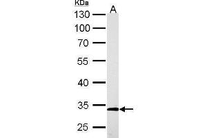 Western Blotting (WB) image for anti-Actin Related Protein 2/3 Complex, Subunit 2, 34kDa (ARPC2) antibody (ABIN2855249)