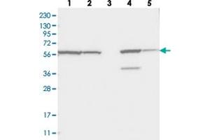 Western blot analysis of Lane 1: RT-4, Lane 2: U-251 MG, Lane 3: Human Plasma, Lane 4: Liver, Lane 5: Tonsil with ZNF354C polyclonal antibody  at 1:250-1:500 dilution. (ZNF354C antibody)