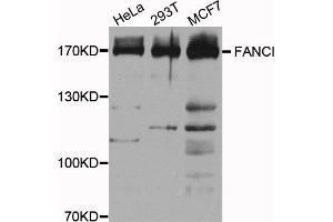 Western blot analysis of extracts of various cell lines, using FANCI antibody. (FANCI antibody)