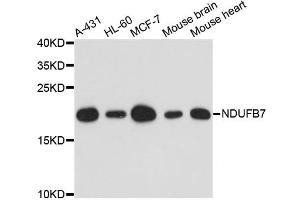 Western blot analysis of extracts of various cell lines, using NDUFB7 antibody. (NDUFB7 antibody)